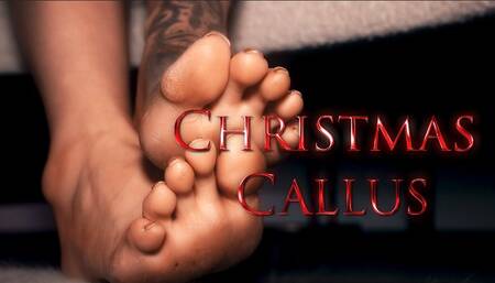 Christmas Callus