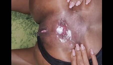 brunette delight, calls me to fuck her ass, gives me a blowjob and an anal prolapse, the ass came out all the way to put the cum