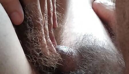 Extremely hairy