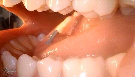 game inside my mouth