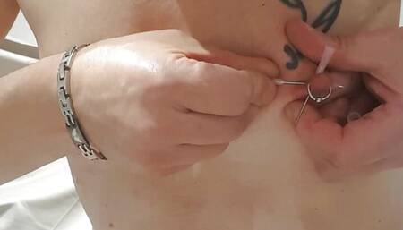 1.2mm infusion needles vertically and horizontally in each nipple pass through the aureola well behind piercings