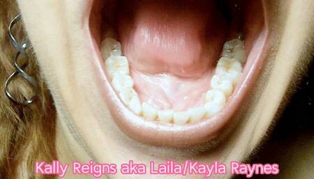 Close Up Mouth and Teeth -Kodak Macro Lens- 117_2539