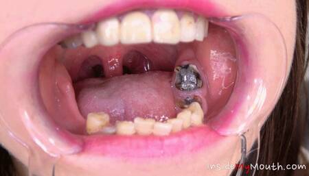 Inside My Mouth - Chanel Kiss - mouth examination and exploration part 2 (HD)