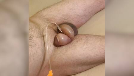 Saline Infusion foreskin