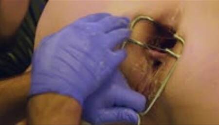 Spread her gaping asshole