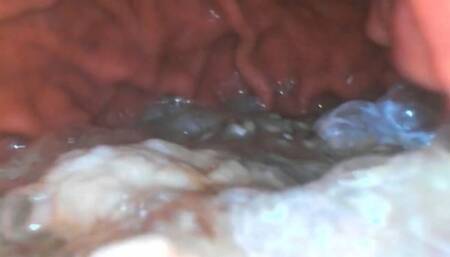 Long Vore exploration with PillCam in VR with PillCam for compatible Htc Vive headsets