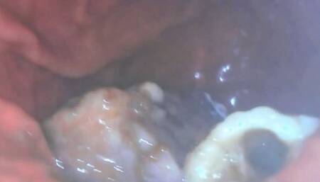 Long Vore exploration with PillCam in VR with PillCam for compatible with Samsung headsets