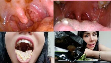 Eating a lot of food -Endoscopy