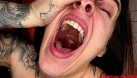 Dancing tonsils & uvula