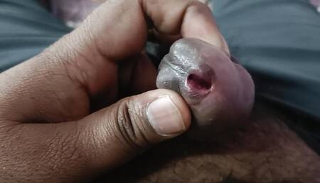 Indian boy have small penis
