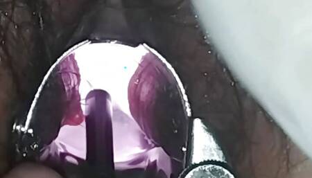 look inside my pussy, while I have a metal vaginal speculum