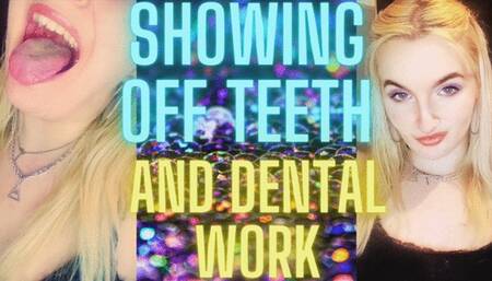 SHOWING OFF TEETH AND DENTAL WORK