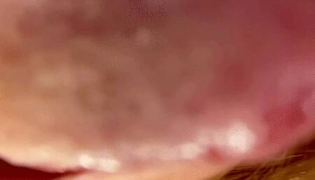 Tongue and Uvula Showcase