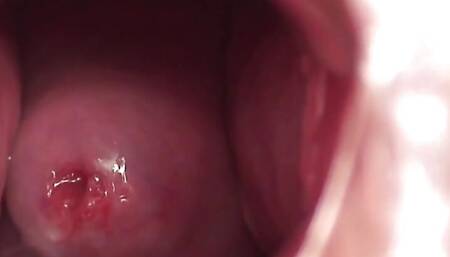 Young nurse gapes her pussy and shows her cervix through the speculum