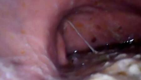 Complete video in Full Screen I eat a lot of sushi at home - The inside of my stomach and the first part of my mouth 720HD