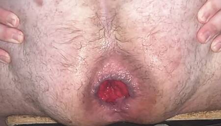 Superchub new ass workout for rosebud, prolapse growth