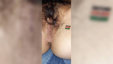 Nairobi anus