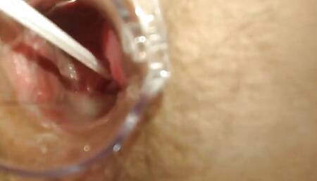 Gyno exam with speculum close up in hairy pussy