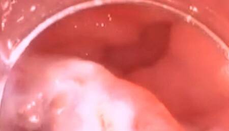 Eating Digesting Basmati Rice - Extreme Vore Exploration 720AVI