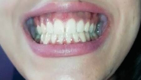 Show my mouth and teeth 12