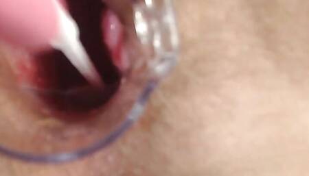 Gyno exam with speculum close up in hairy pussy