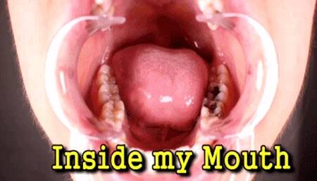 Inside my Mouth (iPhone)