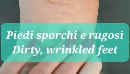 Dirty, wrinkled feet