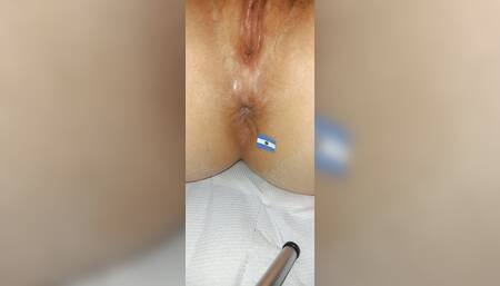 Buenos Aires anus