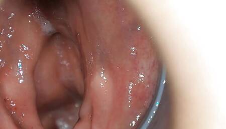 Extremely deep insights into my rectum!