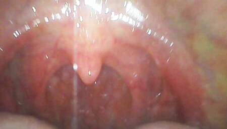 APOLLO: Intruder's Endoscope Journey: From Entry to Exit - Vore Macrophilia