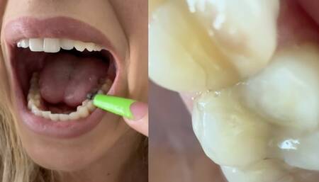 Teeth Tour and Dentist Stories