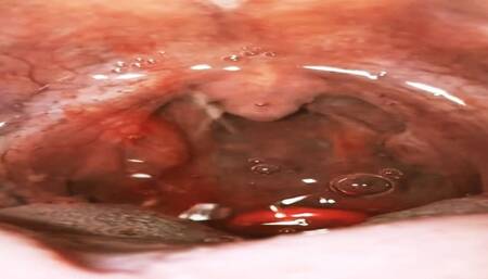 Eating gummies with sparkling water - Experience Vore uvula wide open 720HD