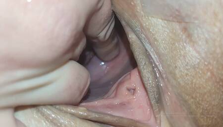 Cervix for Namsei Close-up
