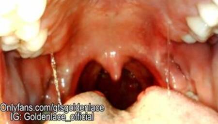 Gummy vore with endo cam