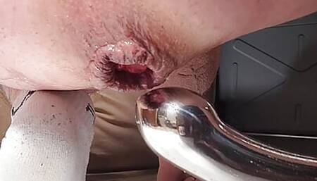 Pussy Gaped Anal prostate milking. Prolapsed pounding njoy eleven anal toy
