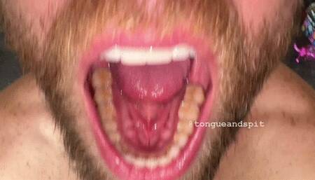 Andrew Teeth Bottom Molars and Retainer Part17 Video1 - WMV