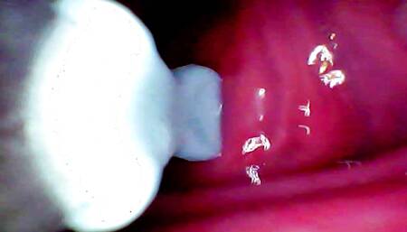 Camera deep inside records female orgasm