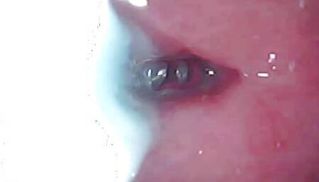 The camera in the penis shows the best picture of the male orgasm event