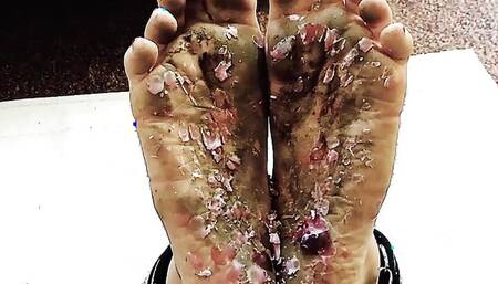 Hard Falaka Foot Burning and Torment for a dirty feet submissive girl chained and restraint ! MKsubtility real BDSM couple 247