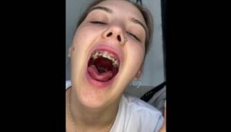 Gigantess with braces chews her tinys
