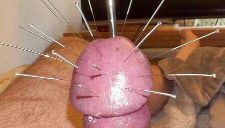 Estim and Acorn - Acupuncture!