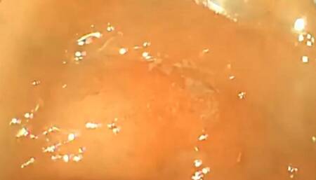 The doctor explores my belly full of meat to digest - FullScreen Exploration 1080HD