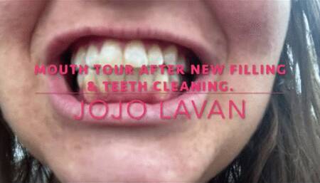 Mouth Tour right after DENTAL CLEANING and NEW FILLING