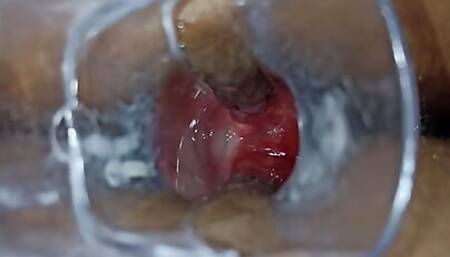 Kendall 9 masturbates her tight anus with a speculum