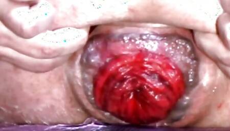 ANITACOX69 Anal Stuffing and Prolapse Pumping