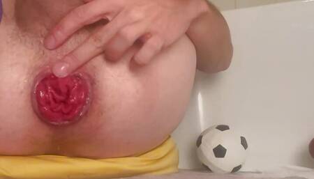 Extreme Punch Fisting Sissy Twinks Juicy Prolapsed Rosebud