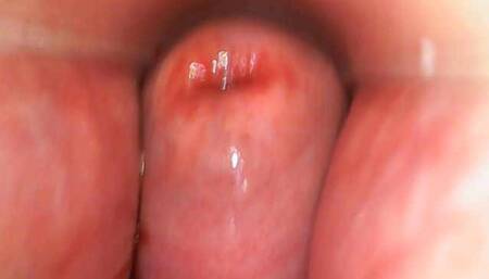 My Cervix up Close
