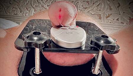 The Xtreme Analizt Rides Again!