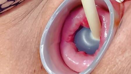 Inject Ink Deep Into My Uterus