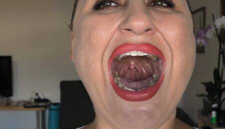 Finger on uvula ORDER